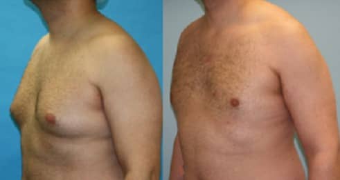 Slider image (10) Cancun Plastic Surgery Center by Dr. Víctor Sámano